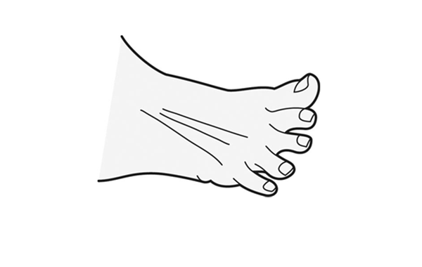 Toe spread exercise