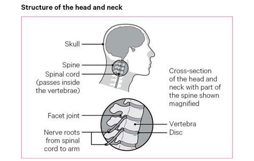 Structure of the head and neck comprises of the skull, spinal cord, facet joints and nerve roots.
