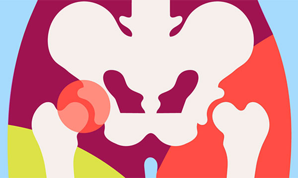 An introduction to arthritis
