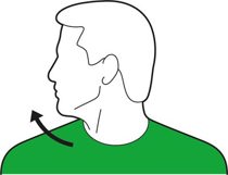 Head turn to the left