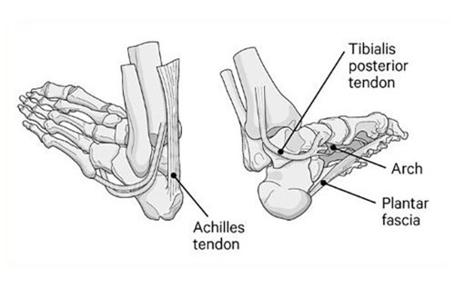 Main structures of the feet that are affected by foot pain, including the Achilles tendon, the Tibialis posterior tendon, the Arch, and the Plantar fascia.