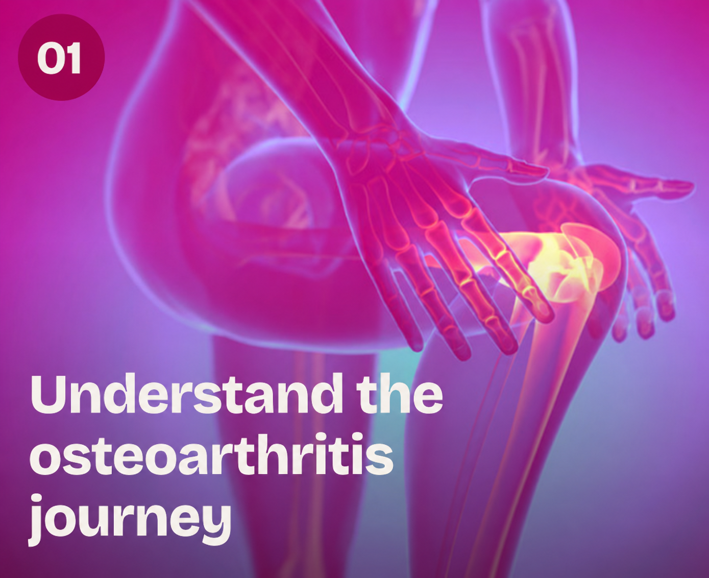 Understand The Osteoarthritis Journey 