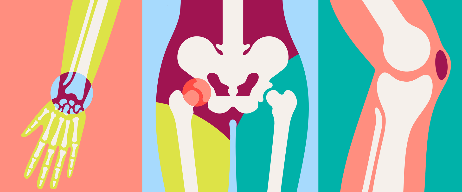Cover image for MSK healthcare in Northern Ireland report