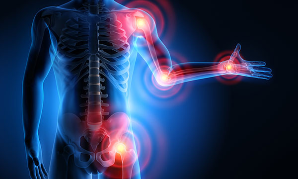 Osteoarthritis research