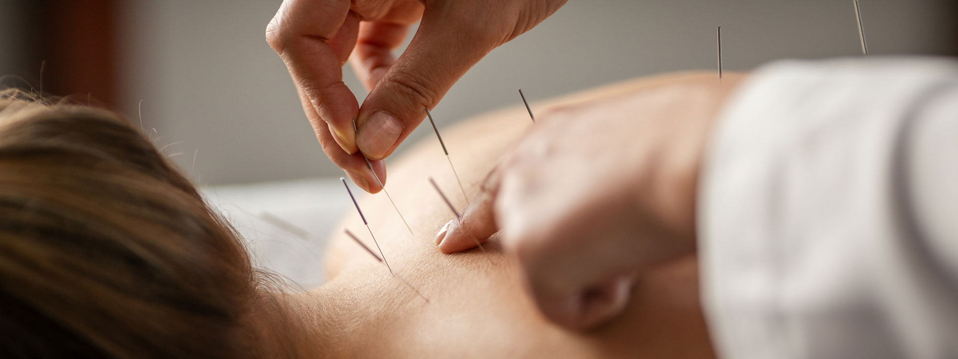 Acupuncture complementary therapy for arthritis pain