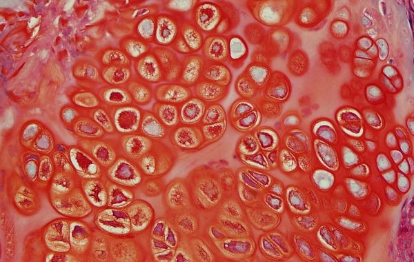 Bouncing Cells Arthritis UK