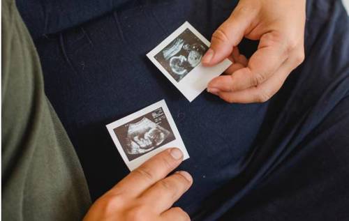 Partners holding scan of baby