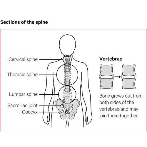 The sections of the spine consist of cervical, thoracic, lumbar spine, the sacroiliac joint and the cocyx.
